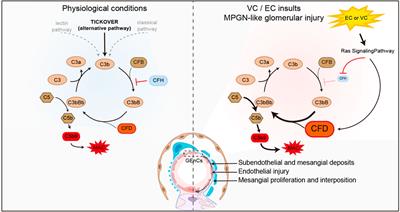 Glomerular injury induced by vinyl carbamate in A/J inbred mice: a novel model of membranoproliferative glomerulonephritis